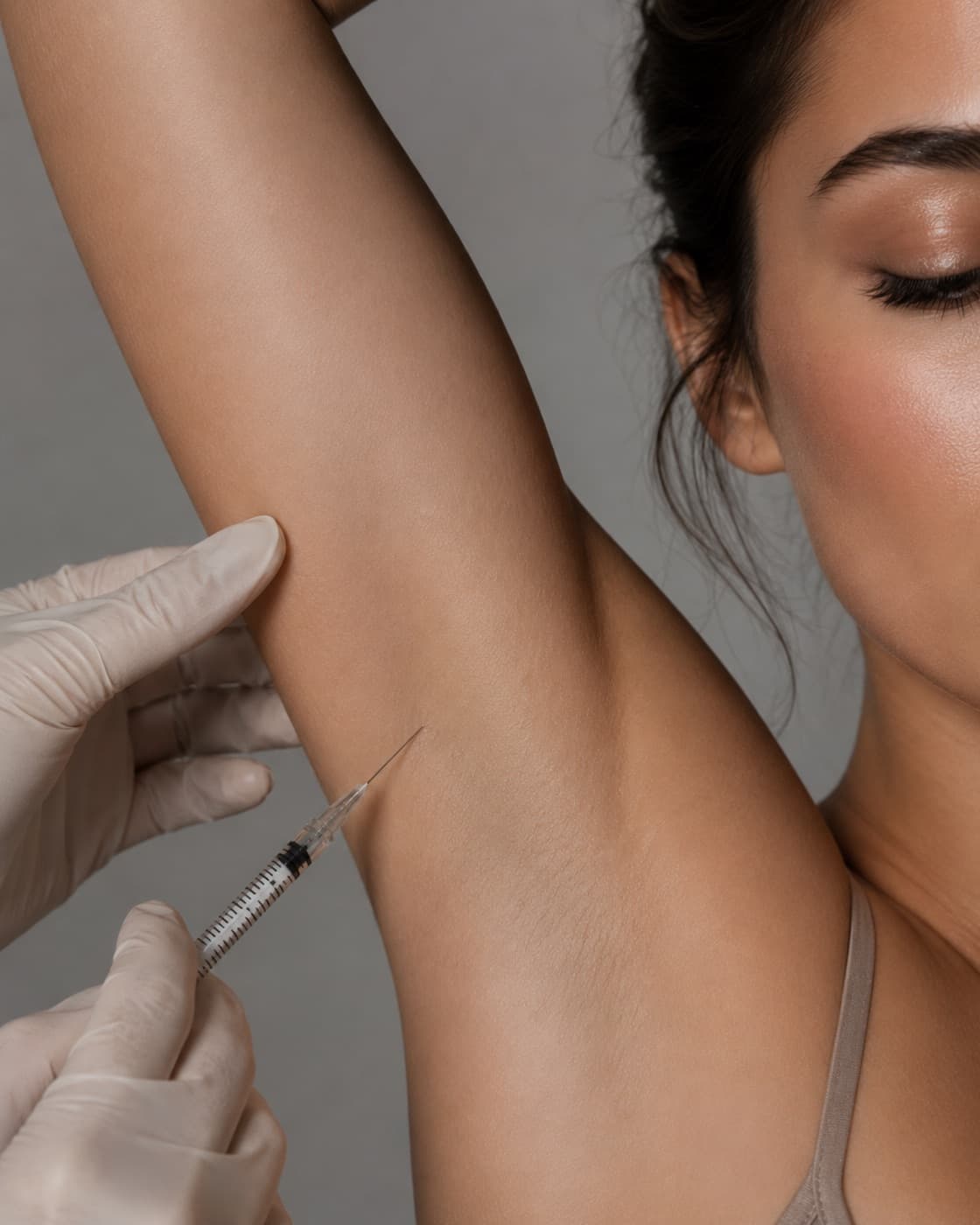 Toxina botulínica para hiperhidrosis
